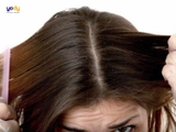 Nhuộm tóc xong bị gàu - Top 5 dầu gội trị gàu cho tóc nhuộm