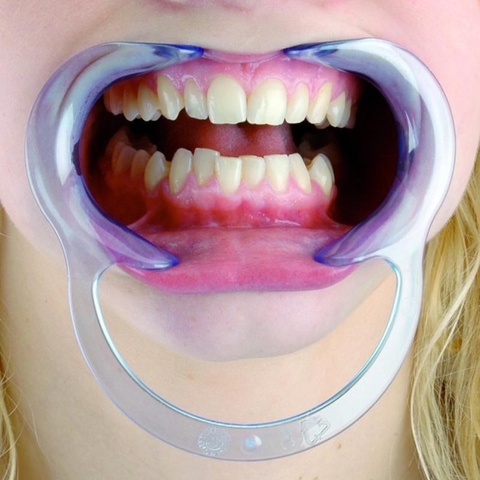 Dụng cụ banh miệng chữ C dùng trong nha khoa, chăm sóc răng miệng, làm trắng răng, đính đá