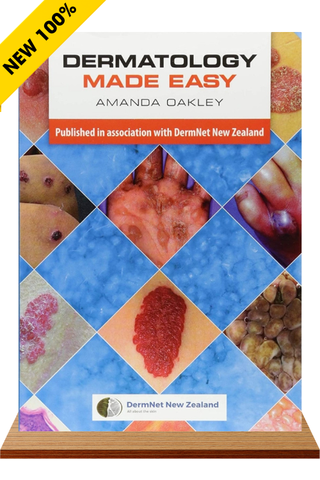 Sách ngoại văn Dermatology Made Easy 1st Edition